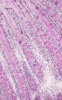 upper extended